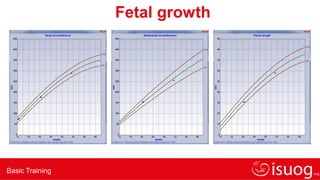 Basic Training
Fetal growth
 