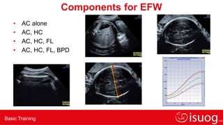 Basic Training
Components for EFW
• AC alone
• AC, HC
• AC, HC, FL
• AC, HC, FL, BPD
 