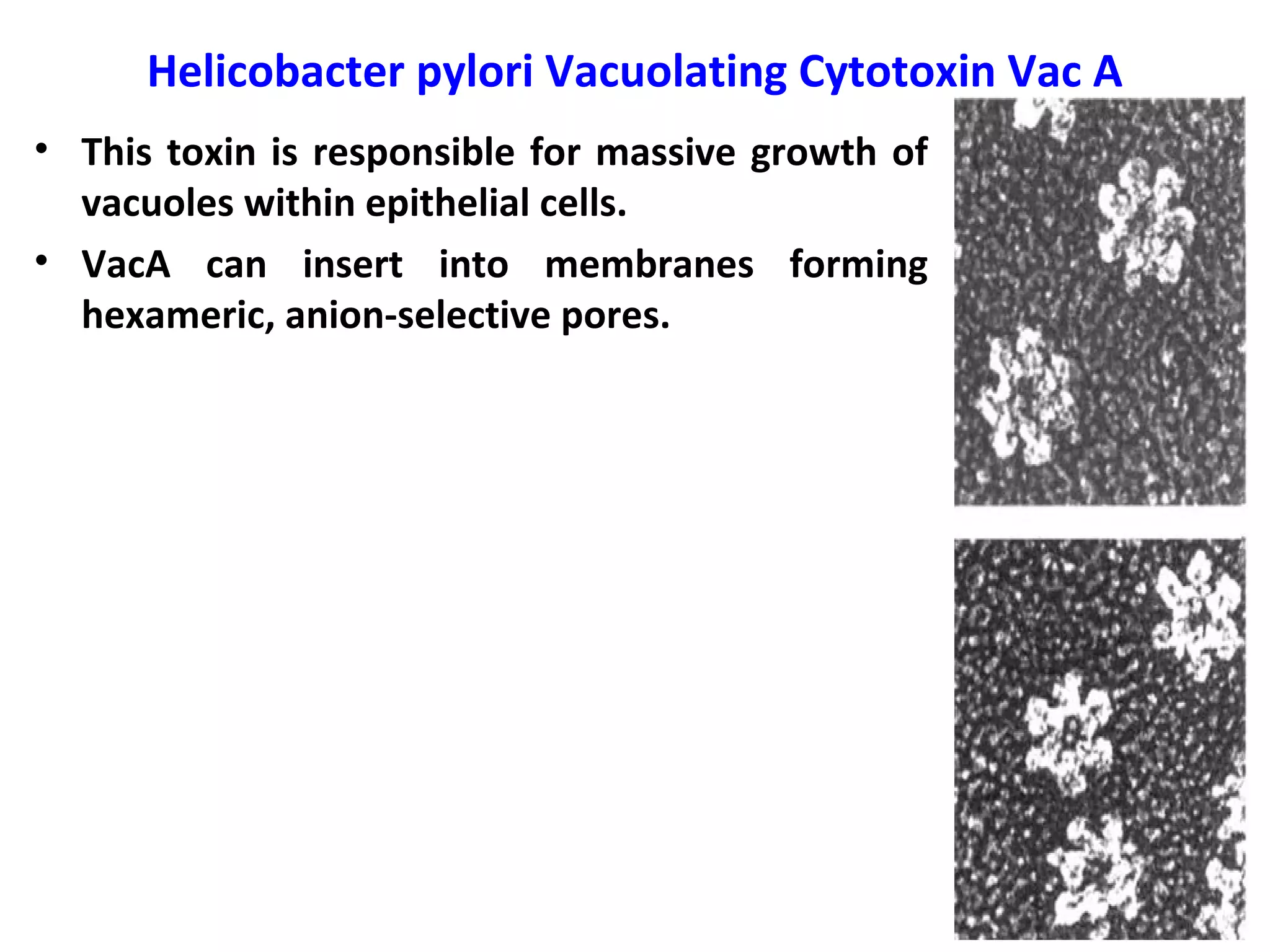 Helicobacter pylori Vacuolating Cytotoxin Vac A
• This toxin is responsible for massive growth of
vacuoles within epithelial cells.
• VacA can insert into membranes forming
hexameric, anion-selective pores.
 