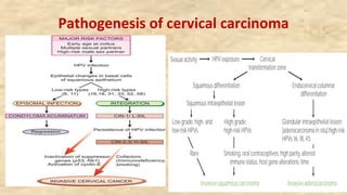 Pathogenesis of cervical carcinoma
 