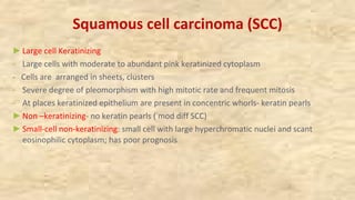 Squamous cell carcinoma (SCC)
►Large cell Keratinizing
- Large cells with moderate to abundant pink keratinized cytoplasm
- Cells are arranged in sheets, clusters
- Severe degree of pleomorphism with high mitotic rate and frequent mitosis
- At places keratinized epithelium are present in concentric whorls- keratin pearls
►Non –keratinizing- no keratin pearls ( mod diff SCC)
►Small-cell non-keratinizing: small cell with large hyperchromatic nuclei and scant
eosinophilic cytoplasm; has poor prognosis
 