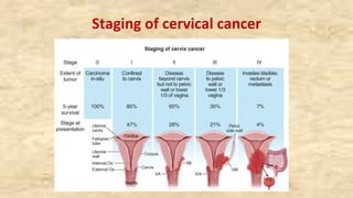 Staging of cervical cancer
 