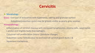 Cervicitis
►Morphology:
Gross- Eversion of ectocervix with hyperemia, edema and granular surface
Nabothian(retention cysts) may be grossly visible as pearly grey vesicles.
Histopathology :
- Inflammation of cervical mucosa with increased lymphocytes, plasma cells, neutrophils
( acute) and tingible body macrophages,
- Columnar cell proliferation (micro- glandular change)
- Nabothian cysts/ follicles (due to occlusion of cervical gland ducts ) &
- Squamous metaplasia
 