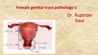 Female genital tract pathology-1
Dr. Rupinder
Kaur
 