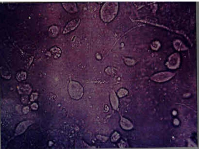 Clindamycin 300mg n2.