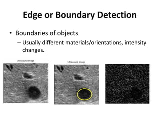 Lecture 2&3 Computer vision image formation ,filters&edge detection | PDF