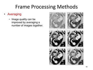 Lecture 2&3 Computer vision image formation ,filters&edge detection | PDF