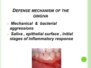 DEFENSE MECHANISM OF THE
GINGIVA
 Mechanical & bacterial
aggressions
 Saliva , epithelial surface , initial
stages of inflammatory response
 