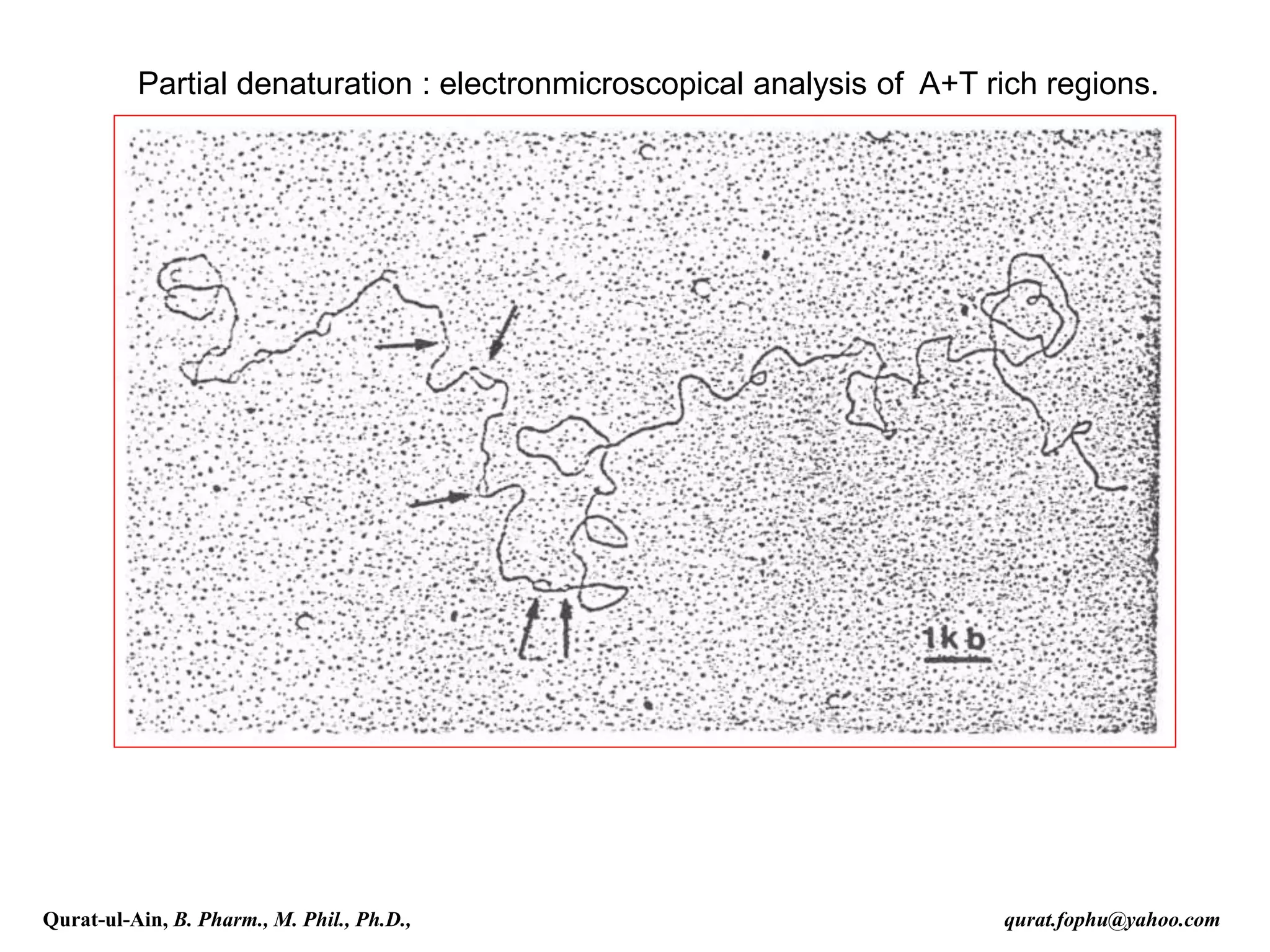 Partial denaturation : electronmicroscopical analysis of A+T rich regions.
Qurat-ul-Ain, B. Pharm., M. Phil., Ph.D., qurat.fophu@yahoo.com
 