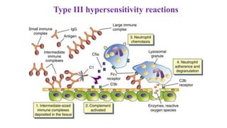 Type III hypersensitivity reactions
 