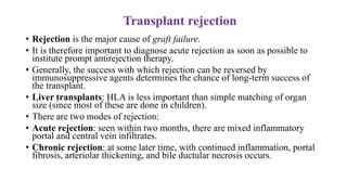Transplant rejection
• Rejection is the major cause of graft failure.
• It is therefore important to diagnose acute rejection as soon as possible to
institute prompt antirejection therapy.
• Generally, the success with which rejection can be reversed by
immunosuppressive agents determines the chance of long-term success of
the transplant.
• Liver transplants: HLA is less important than simple matching of organ
size (since most of these are done in children).
• There are two modes of rejection:
• Acute rejection: seen within two months, there are mixed inflammatory
portal and central vein infiltrates.
• Chronic rejection: at some later time, with continued inflammation, portal
fibrosis, arteriolar thickening, and bile ductular necrosis occurs.
 