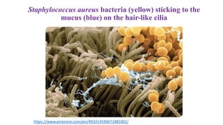 Staphylococcus aureus bacteria (yellow) sticking to the
mucus (blue) on the hair-like cilia
https://www.pinterest.com/pin/493214596671881001/
 