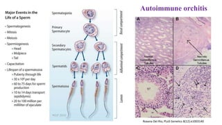 Autoimmune orchitis
Roxana Del Rio, PLoS Genetics 8(12):e1003140
 