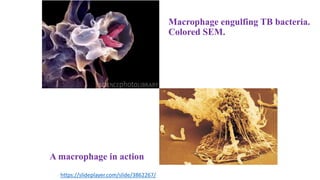 Macrophage engulfing TB bacteria.
Colored SEM.
A macrophage in action
https://slideplayer.com/slide/3862267/
 