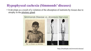 Hypophyseal cachexia (Simmonds’ diseases)
• It develops as a result of a violation of the absorption of nutrients by tissues due to
atrophy in the pituitary gland.
https://healthjade.net/simmonds-disease/
 