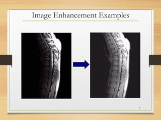 Image Enhancement Examples
6
 