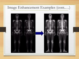 Image Enhancement Examples (cont.…)
7
 