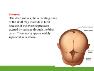 Sutures:
The skull sutures, the separating lines
of the skull may override at birth
because of the extreme pressure
exerted by passage through the birth
canal. These never appear widely
separated in newborn.
 