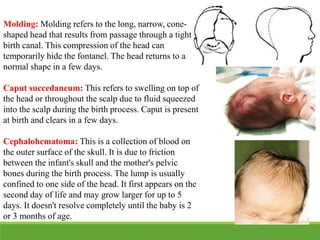 Molding: Molding refers to the long, narrow, cone-
shaped head that results from passage through a tight
birth canal. This compression of the head can
temporarily hide the fontanel. The head returns to a
normal shape in a few days.
Caput succedaneum: This refers to swelling on top of
the head or throughout the scalp due to fluid squeezed
into the scalp during the birth process. Caput is present
at birth and clears in a few days.
Cephalohematoma: This is a collection of blood on
the outer surface of the skull. It is due to friction
between the infant's skull and the mother's pelvic
bones during the birth process. The lump is usually
confined to one side of the head. It first appears on the
second day of life and may grow larger for up to 5
days. It doesn't resolve completely until the baby is 2
or 3 months of age.
 