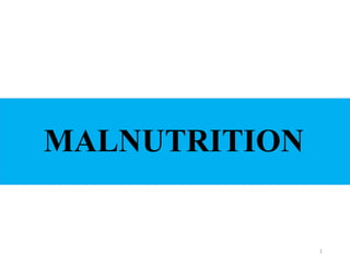 1
MALNUTRITION
 
