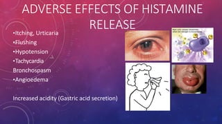 ADVERSE EFFECTS OF HISTAMINE
RELEASE
•Itching, Urticaria
•Flushing
•Hypotension
•Tachycardia
Bronchospasm
•Angioedema
Increased acidity (Gastric acid secretion)
 