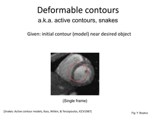 Deformable contours
Given: initial contour (model) near desired object
a.k.a. active contours, snakes
(Single frame)
Fig: Y. Boykov
[Snakes: Active contour models, Kass, Witkin, & Terzopoulos, ICCV1987]
 
