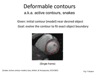 Deformable contours
Given: initial contour (model) near desired object
a.k.a. active contours, snakes
(Single frame)
Fig: Y. Boykov
Goal: evolve the contour to fit exact object boundary
[Snakes: Active contour models, Kass, Witkin, & Terzopoulos, ICCV1987]
 