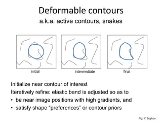 Deformable contours
initial intermediate final
a.k.a. active contours, snakes
Fig: Y. Boykov
Initialize near contour of interest
Iteratively refine: elastic band is adjusted so as to
• be near image positions with high gradients, and
• satisfy shape “preferences” or contour priors
 