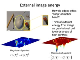 External image energy
Magnitude of gradient
- (Magnitude of gradient)
 22
)()( IGIG yx 
22
)()( IGIG yx 
How do edges affect
“snap” of rubber
band?
Think of external
energy from image
as gravitational pull
towards areas of
high contrast
 