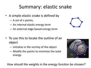 Summary: elastic snake
• A simple elastic snake is defined by
– A set of n points,
– An internal elastic energy term
– An external edge based energy term
• To use this to locate the outline of an
object
– Initialize in the vicinity of the object
– Modify the points to minimize the total
energy
How should the weights in the energy function be chosen?
 