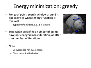 Energy minimization: greedy
• For each point, search window around it
and move to where energy function is
minimal
– Typical window size, e.g., 5 x 5 pixels
• Stop when predefined number of points
have not changed in last iteration, or after
max number of iterations
• Note
– Convergence not guaranteed
– Need decent initialization
 