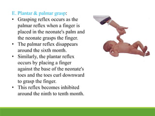 E. Plantar & palmar grasp:
• Grasping reflex occurs as the
palmar reflex when a finger is
placed in the neonate's palm and
the neonate grasps the finger.
• The palmar reflex disappears
around the sixth month.
• Similarly, the plantar reflex
occurs by placing a finger
against the base of the neonate's
toes and the toes curl downward
to grasp the finger.
• This reflex becomes inhibited
around the ninth to tenth month.
 