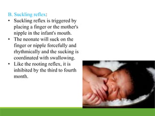 B. Suckling reflex:
• Suckling reflex is triggered by
placing a finger or the mother's
nipple in the infant's mouth.
• The neonate will suck on the
finger or nipple forcefully and
rhythmically and the sucking is
coordinated with swallowing.
• Like the rooting reflex, it is
inhibited by the third to fourth
month.
 