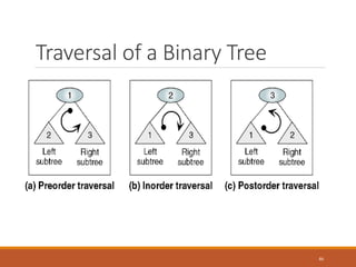 Traversal of a Binary Tree
46
 
