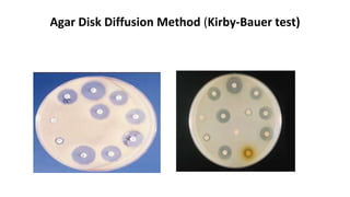 Agar Disk Diffusion Method (Kirby-Bauer test)
 