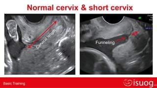 Lecture-8-Cervical-assessment.pdf