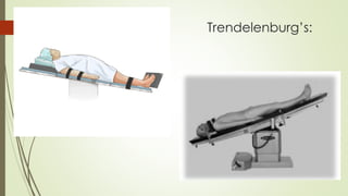 Trendelenburg’s:
 