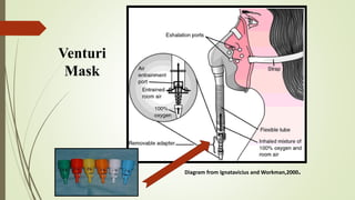 Diagram from Ignatavicius and Workman,2000.
Venturi
Mask
 