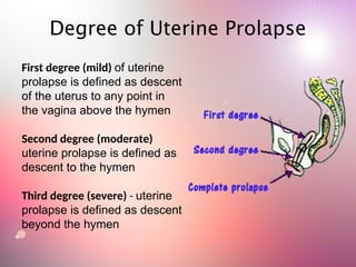 Degree of Uterine Prolapse
First degree (mild) of uterine
prolapse is defined as descent
of the uterus to any point in
the vagina above the hymen
Second degree (moderate)
uterine prolapse is defined as
descent to the hymen
Third degree (severe) - uterine
prolapse is defined as descent
beyond the hymen
 