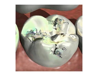 Amorphous Computing (Computación Amorfa)