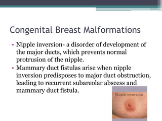 Congenital Breast Malformations
• Nipple inversion- a disorder of development of
the major ducts, which prevents normal
protrusion of the nipple.
• Mammary duct fistulas arise when nipple
inversion predisposes to major duct obstruction,
leading to recurrent subareolar abscess and
mammary duct fistula.
 