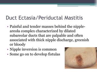 Duct Ectasia/Periductal Mastitis
• Painful and tender masses behind the nipple-
areola complex characterized by dilated
subareolar ducts that are palpable and often
associated with thick nipple discharge, greenish
or bloody
• Nipple inversion is common
• Some go on to develop fistulas
 