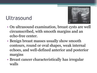 Ultrasound
• On ultrasound examination, breast cysts are well
circumscribed, with smooth margins and an
echo-free center.
• Benign breast masses usually show smooth
contours, round or oval shapes, weak internal
echoes, and well-defined anterior and posterior
margins
• Breast cancer characteristically has irregular
walls
 