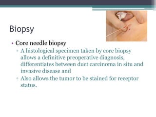 Biopsy
• Core needle biopsy
▫ A histological specimen taken by core biopsy
allows a definitive preoperative diagnosis,
differentiates between duct carcinoma in situ and
invasive disease and
▫ Also allows the tumor to be stained for receptor
status.
 