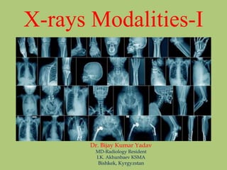 X-rays Modalities-I
Dr. Bijay Kumar Yadav
MD-Radiology Resident
I.K. Akhunbaev KSMA
Bishkek, Kyrgyzstan
 