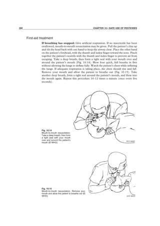 394 CHAPTER 10 • SAFE USE OF PESTICIDES
First-aid treatment
If breathing has stopped: Give artiﬁcial respiration. If no insecticide has been
swallowed, mouth-to-mouth resuscitation may be given. Pull the patient’s chin up
and tilt the head back with one hand to keep the airway clear. Place the other hand
on the patient’s forehead, with the thumb and index ﬁnger toward the nose. Pinch
together the patient’s nostrils with the thumb and index ﬁnger to prevent air from
escaping. Take a deep breath, then form a tight seal with your mouth over and
around the patient’s mouth (Fig. 10.14). Blow four quick, full breaths in ﬁrst
without allowing the lungs to deﬂate fully. Watch the patient’s chest while inﬂating
the lungs. If adequate respiration is taking place, the chest should rise and fall.
Remove your mouth and allow the patient to breathe out (Fig. 10.15). Take
another deep breath, form a tight seal around the patient’s mouth, and blow into
the mouth again. Repeat this procedure 10–12 times a minute (once every ﬁve
seconds).
Fig. 10.15
Mouth-to-mouth resuscitation. Remove your
mouth and allow the patient to breathe out (©
WHO).
Fig. 10.14
Mouth-to-mouth resuscitation.
Take a deep breath, then form
a tight seal with your mouth
over and around the patient’s
mouth (© WHO).
 