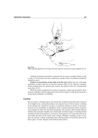 PRECAUTIONS 395
EMERGENCY MEASURES 395
Fig. 10.16
Wash pesticide splashes from the eyes with clean water for at least ﬁve minutes (adapted from 3).
Artiﬁcial respiration should be continued for as long as possible if there is still
a pulse. If insecticide has been swallowed, another form of artiﬁcial ventilation
should be used.
If there is insecticide on the skin or in the eyes: Rinse the eyes with large
quantities of clean water for at least ﬁve minutes (Fig. 10.16). Remove contami-
nated clothing from the patient and remove the patient from the contaminated
area (Fig. 10.17).
Wash the body completely for at least 10 minutes, using soap if possible. If no
water is available, wipe the skin gently with cloths or paper to soak up the pesticide.
Avoid harsh rubbing or scrubbing.
Vomiting
Do not induce vomiting unless the patient has swallowed pesticide that is known
to be highly toxic, and medical help is not expected soon. Never induce vomiting
if the patient has swallowed oil spray or products diluted in diesel or kerosene,
because of the possibility of inhalation of the vomited material, which would be
more dangerous than the intestinal poisoning. The product label should indicate
whether the pesticide is highly toxic (skull-and-crossbones signs). Vomiting should
be induced only if the patient is conscious. If necessary, sit or stand the person up
and tickle the back of the throat with a ﬁnger. Whether vomiting occurs or not,
give the patient a drink comprising three tablespoonfuls of activated charcoal in
half a glass of water. Repeat until medical help arrives.
 