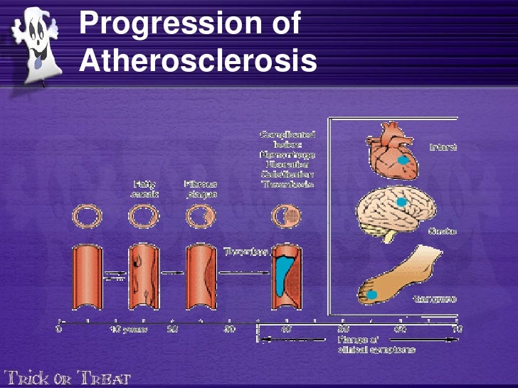 Lecture Xv Arteriosclerosis And Atherosclerosis 11 Lecture Xv Arteriosclerosis And Atherosclerosis 11