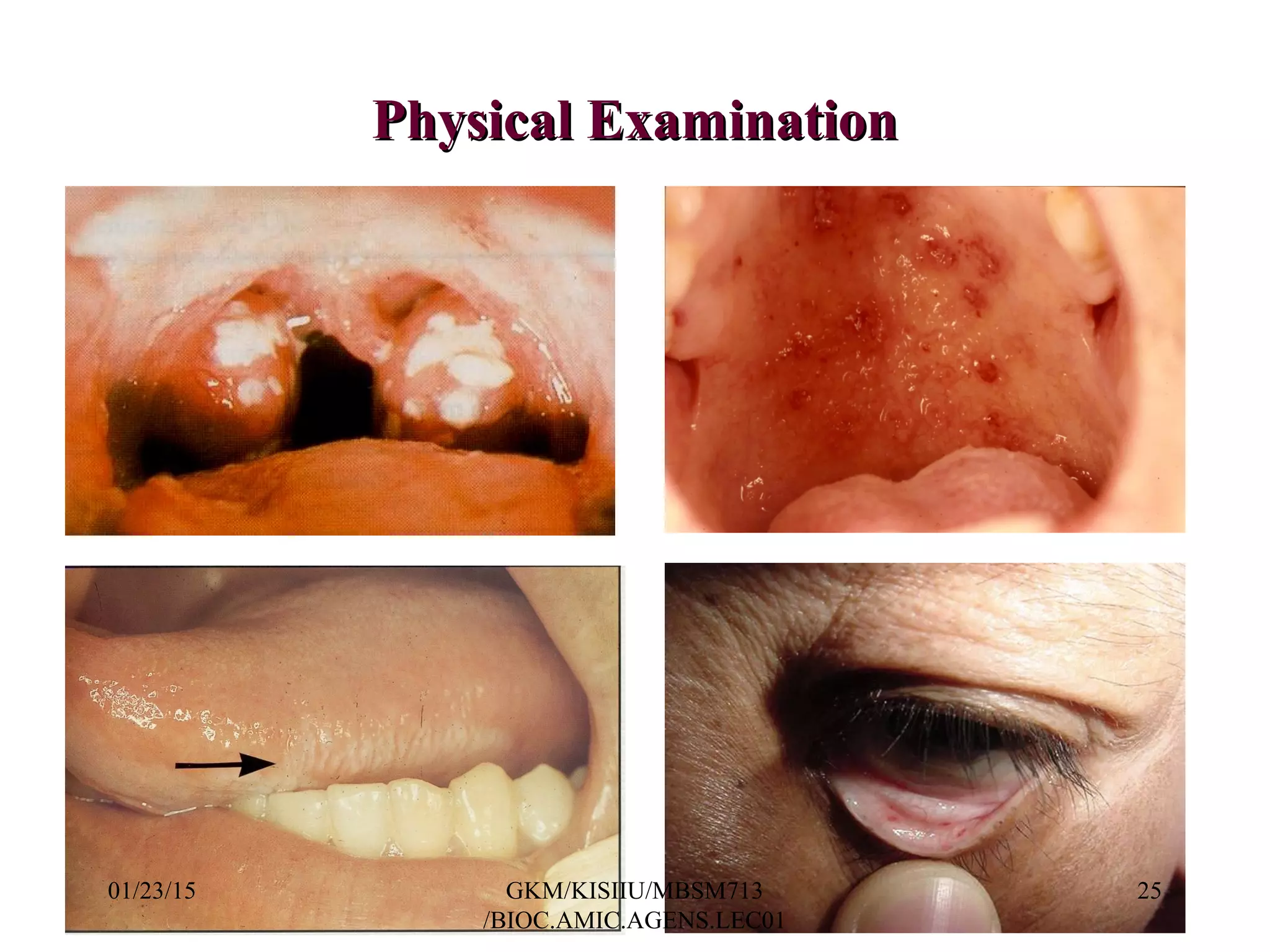 Physical ExaminationPhysical Examination
01/23/15 25GKM/KISIIU/MBSM713
/BIOC.AMIC.AGENS.LEC01
 