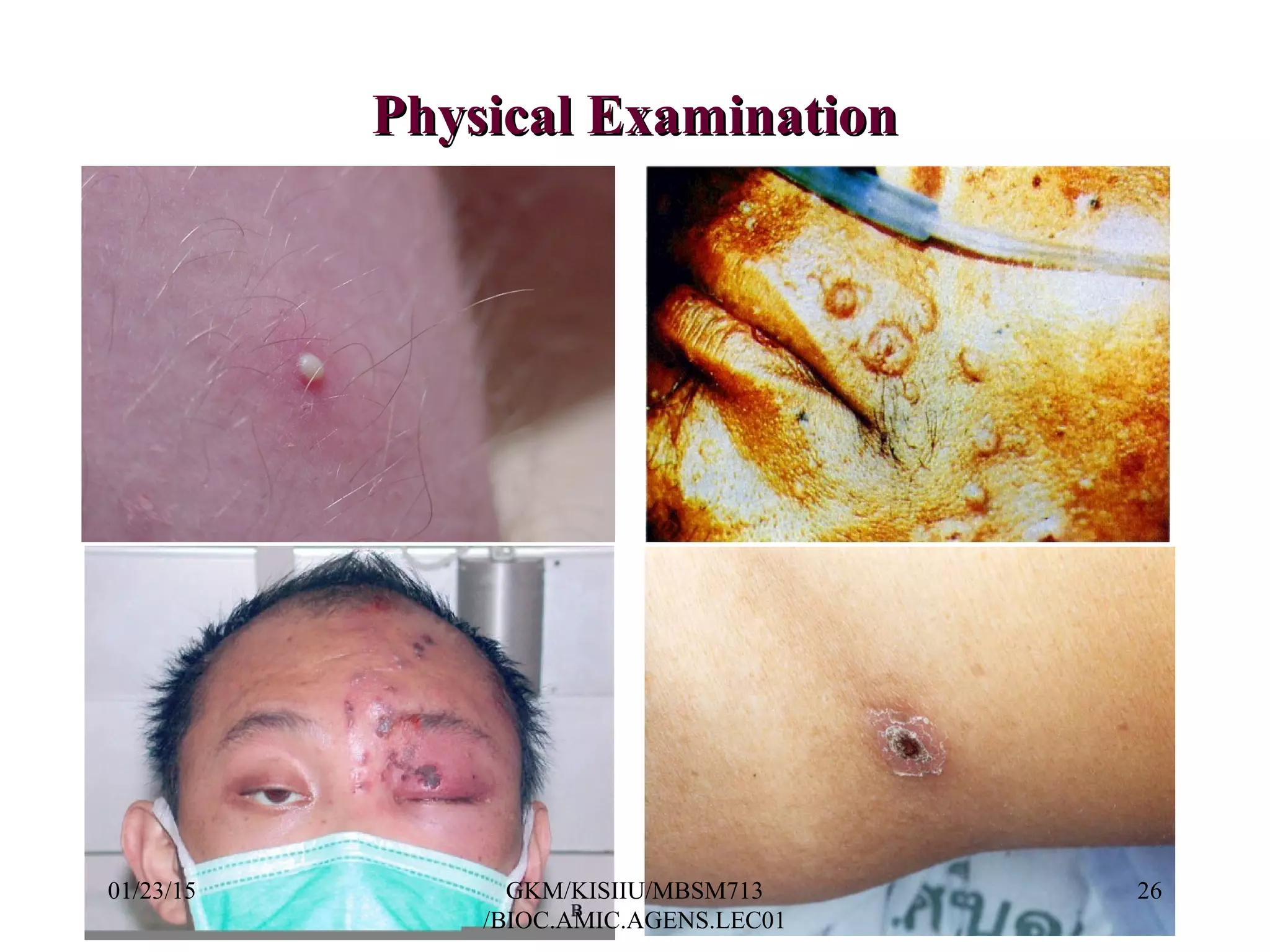 Physical ExaminationPhysical Examination
01/23/15 26GKM/KISIIU/MBSM713
/BIOC.AMIC.AGENS.LEC01
 